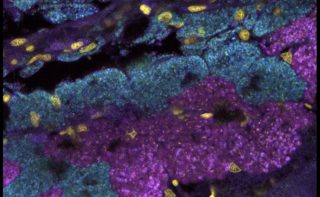 Diese Aufnahme aus dem Fluoreszenzmikroskop zeigt, dass die Kiemen der Mondmuscheln voll mit Symbionten (grün und magenta gefärbt) sind (Zellkerne der Muscheln in gold). Die Mondmuscheln beherbergen sie in spezialisierten Zellen, den Bakteriozyten.