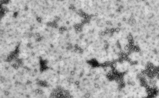 Extrazelluläre Vesikel des Haloarchaeon Haloferax volcanii, sichtbar gemacht mit einem Elektronenmikroskop. Die Maßstabsleiste misst 500 nm.
